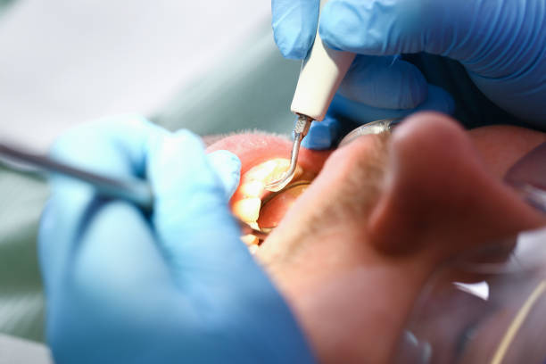 Best Emergency Cosmetic Dentistry (e.g., broken veneers) in Powdersville, SC