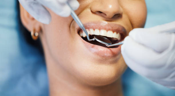 Best Emergency Denture Repair in Powdersville, SC